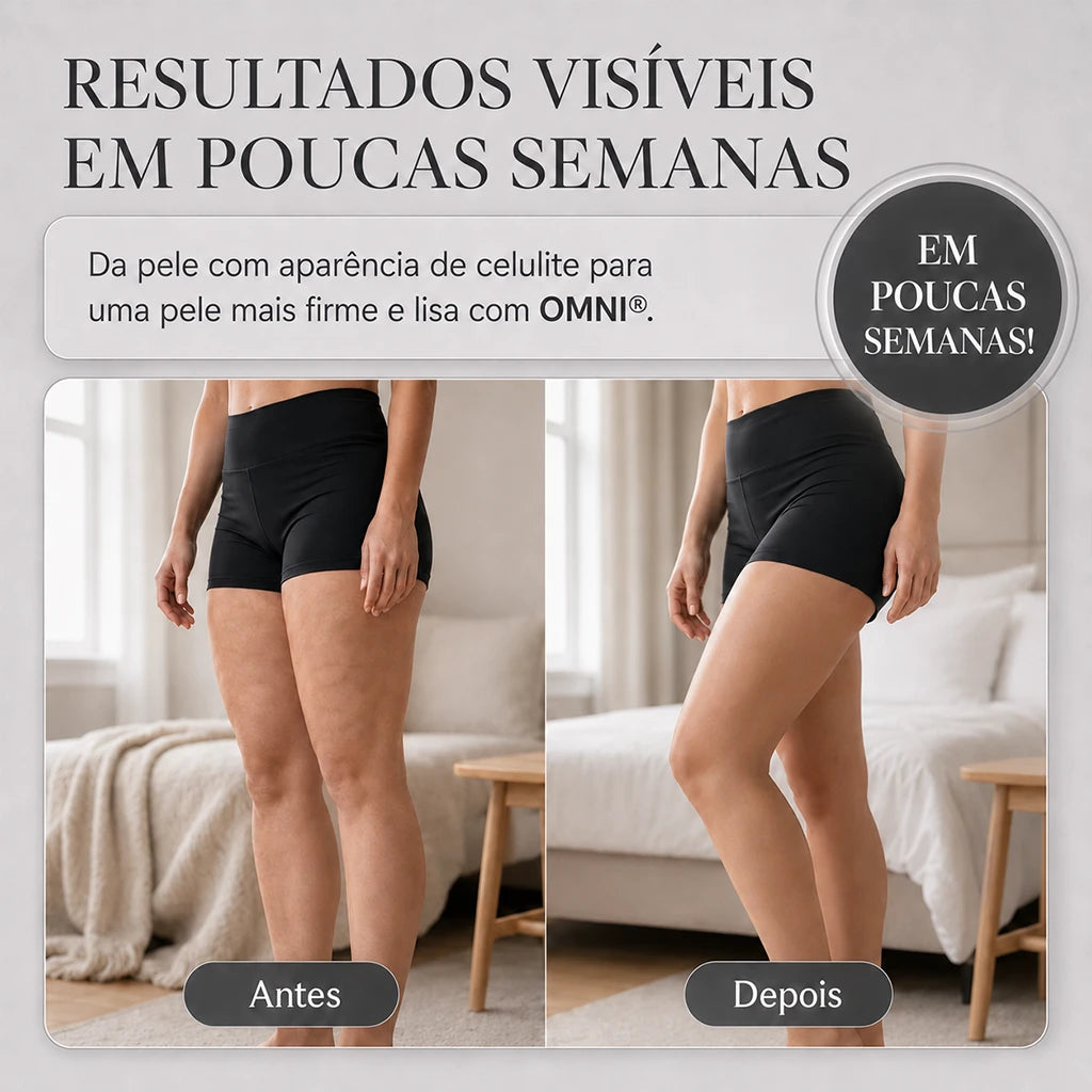OMNI™ Massageador Corporal a Vácuo com LED para Celulite