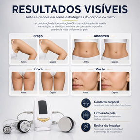 Aparelho Profissional de Lipocavitação 40kHz e Radiofrequência 3 em 1 TRIAVA™