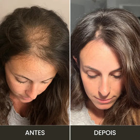 Kit de Alta Frequencia Profissional para Tratamento Capilar e Facial Haute™