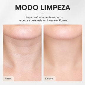 V-SCULPT™ Massageador Facial Lifting com Vibração Sônica e LED Terapêutico